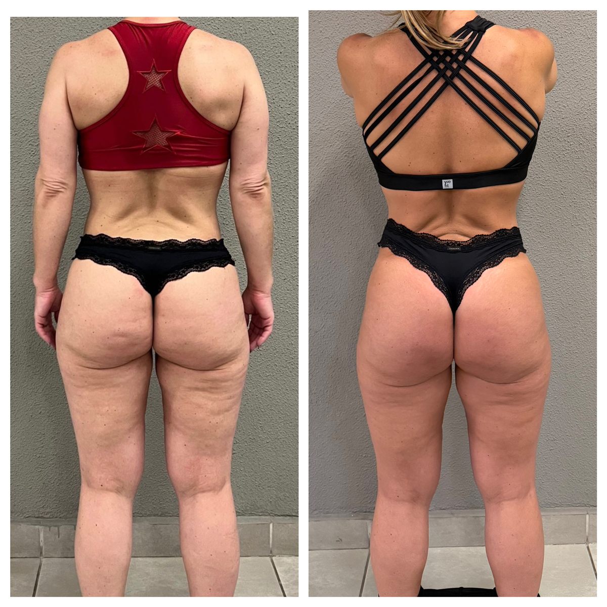 Antes e depois de aluna