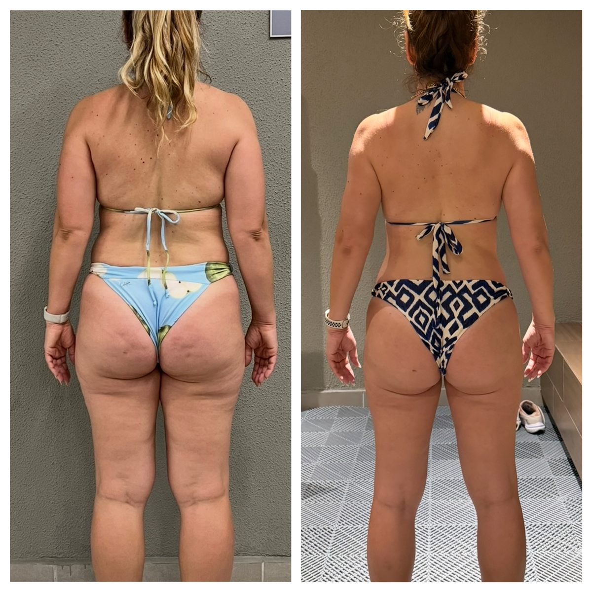 Antes e depois de aluna